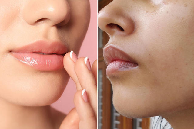 كيفيه ازالة السواد حول الفم