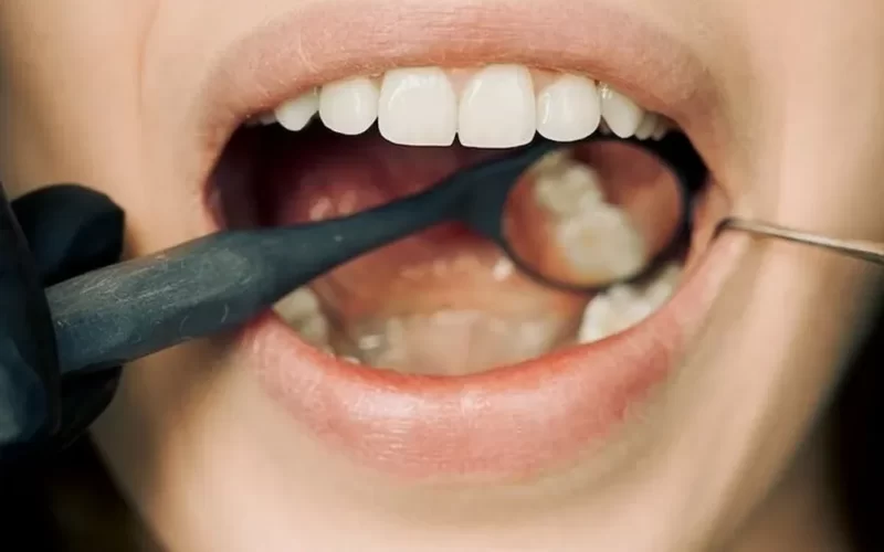 الجديد في عالم الطب دواء يعيد نمو الأسنان التالفة وتعود كالجديد